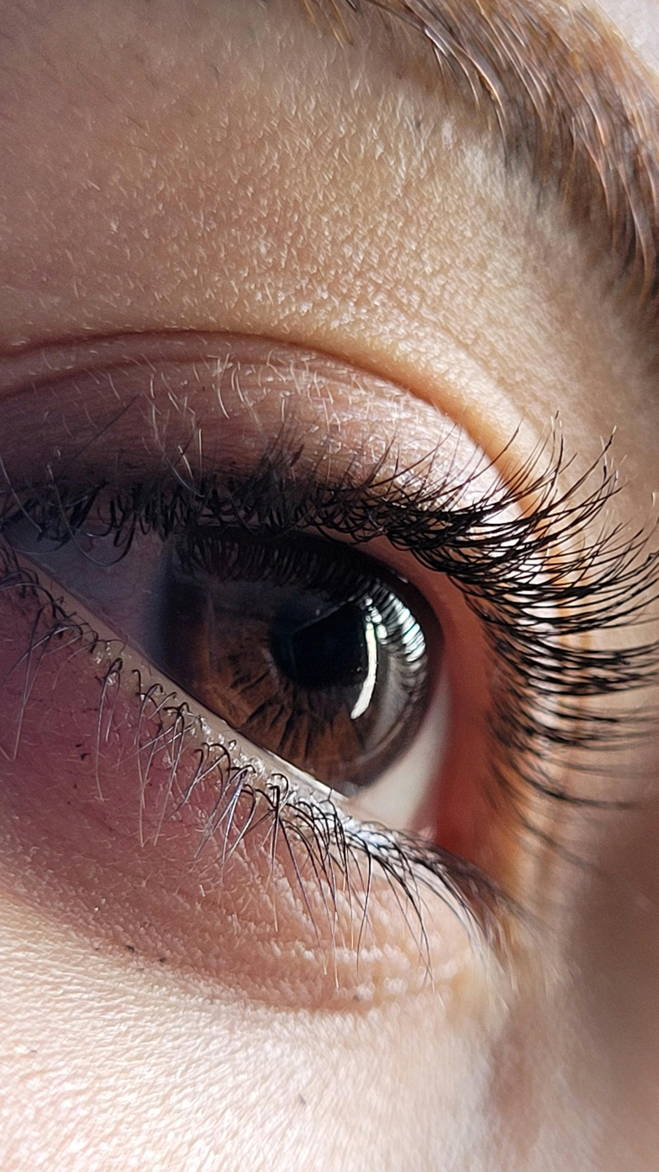 Eyelash Removal