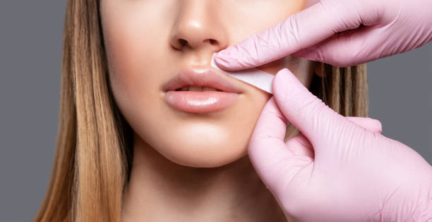 Upper Lip